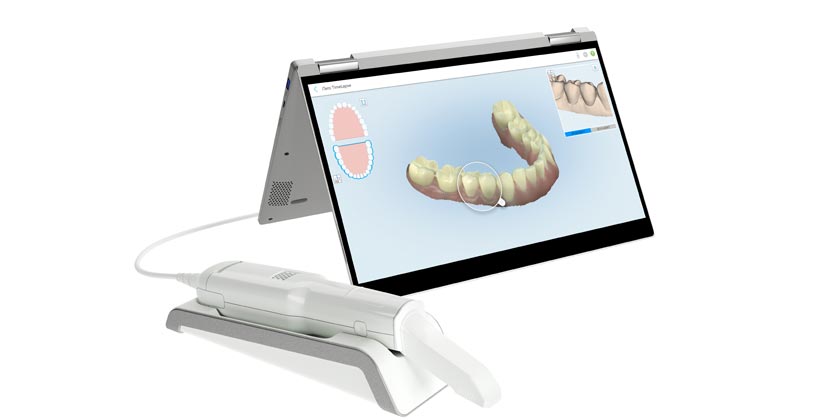 Scanner intraorale iTero Flex
