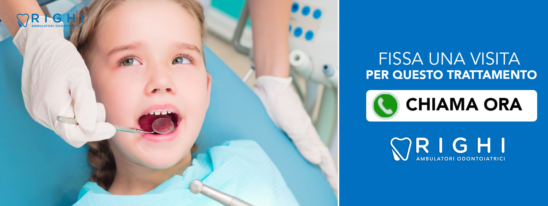 Fluoroprofilassi-dentista-Rivalta (Reggio Emilia)