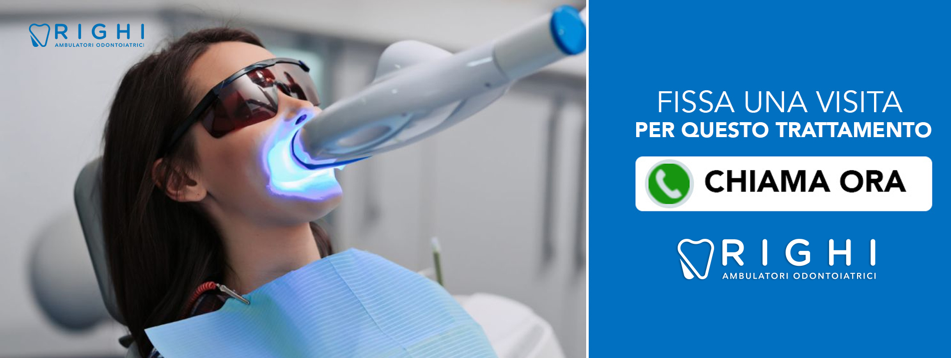 Sbiancamento-dentista-Rivalta (Reggio Emilia)