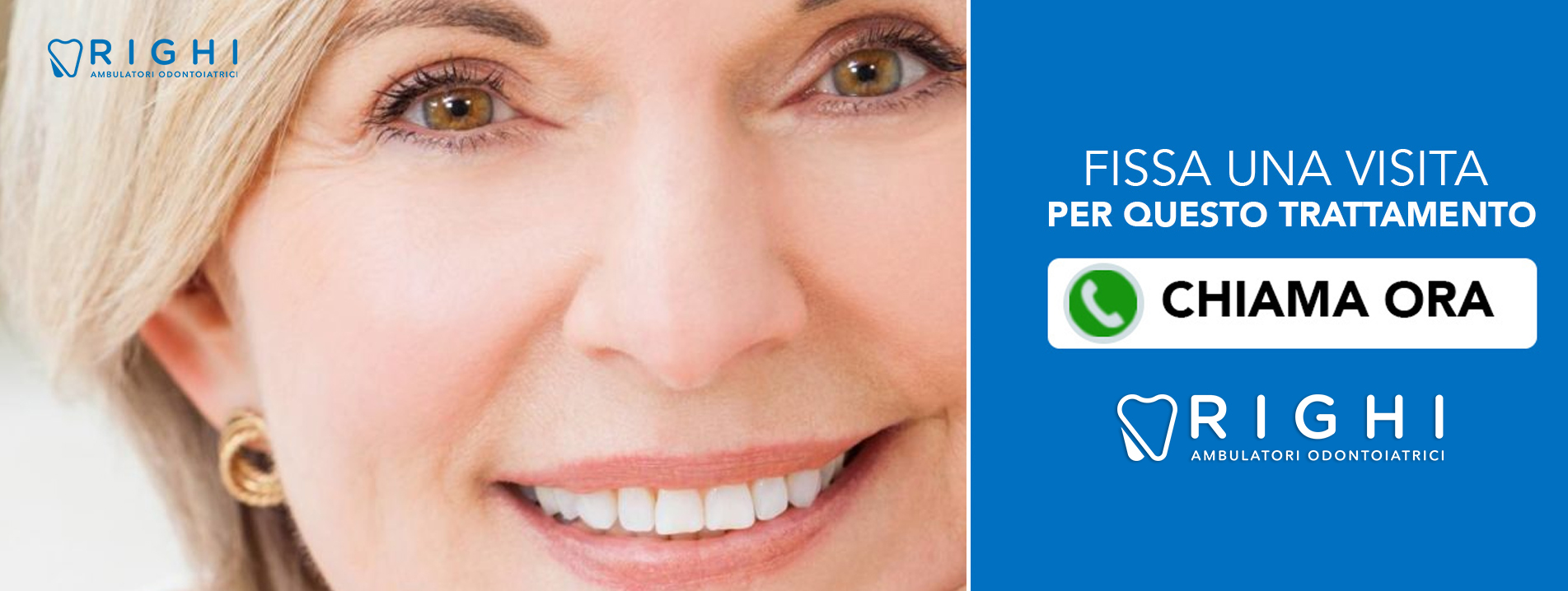 capsule-metal-free-dentista-Rivalta (Reggio Emilia)