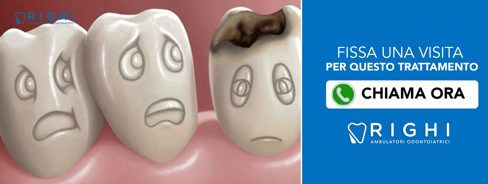 conservativa-dentista-Rivalta (Reggio Emilia)