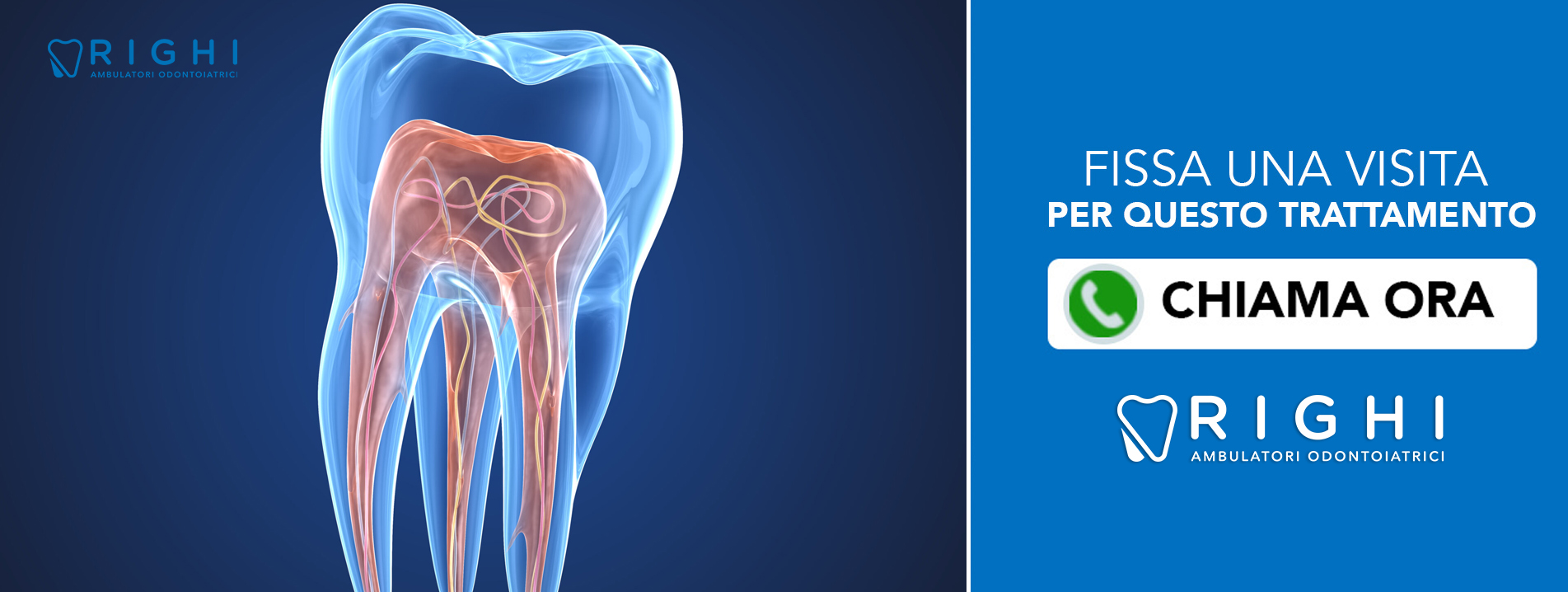 endodonzia-dentista-Rivalta (Reggio Emilia)