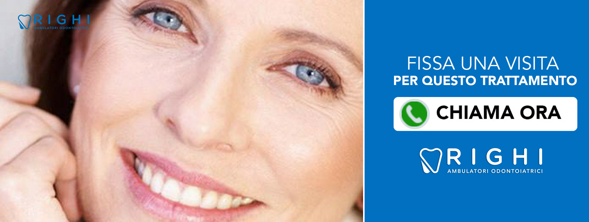 protesi-dentista-Rivalta (Reggio Emilia)